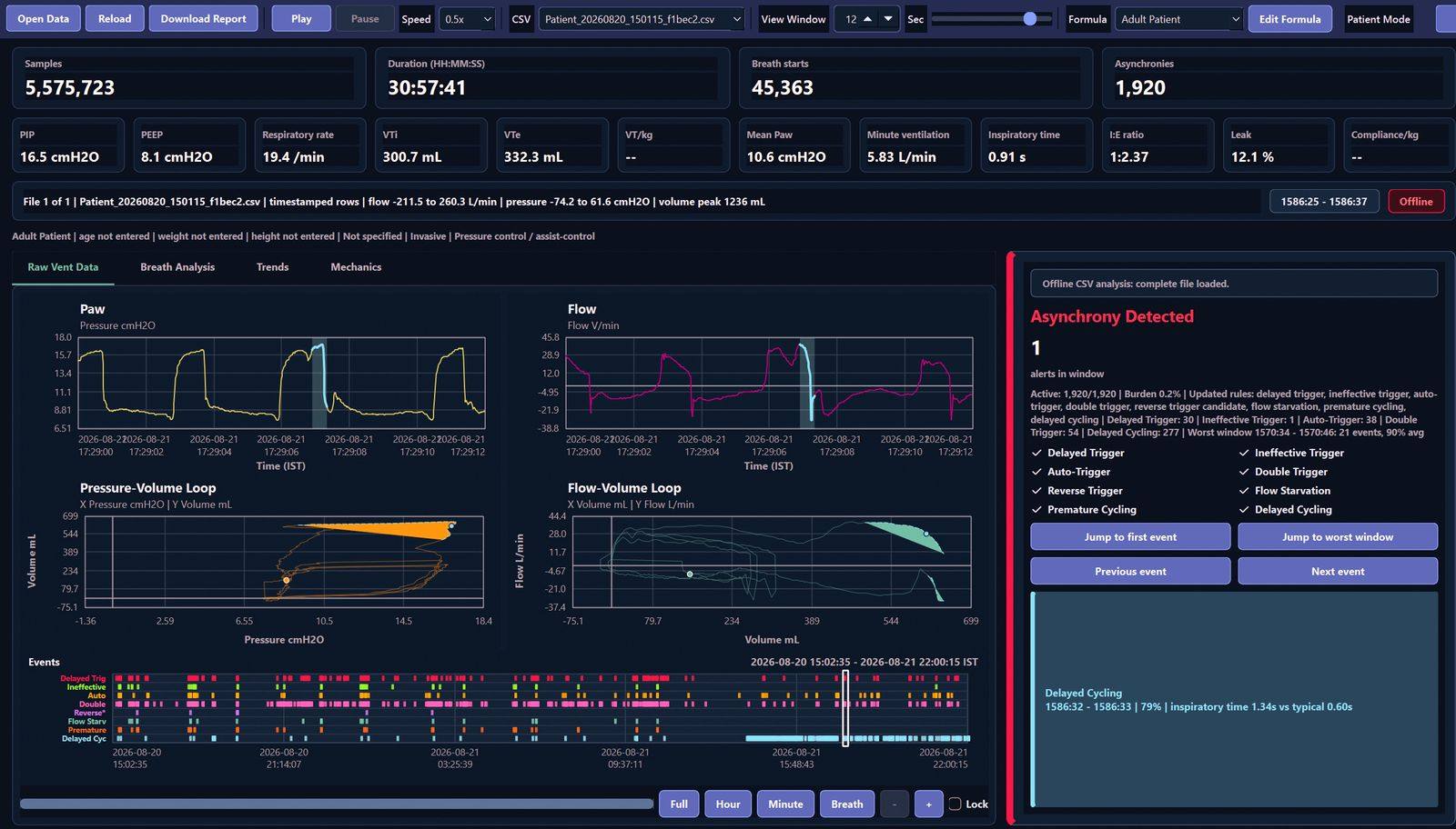 A ventilator analytics dashboard showing pressure and flow waveforms, loop plots, and an asynchrony alert with its cycling detail.