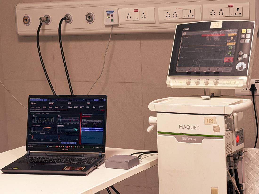 A Maquet Servo-i ventilator beside a laptop running the Plazma analytics dashboard, with a patient monitor above.